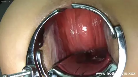 Huge Speculum And Deep Dildo Fuck Movie